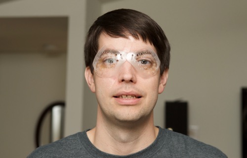 LASIK plastic eye covers on Jeff