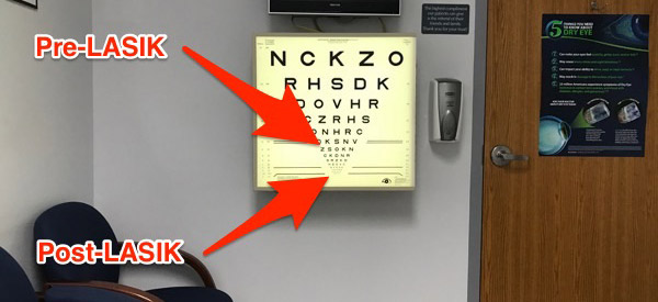 Eye chart reading wall chart before after LASIK comparison